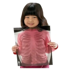 Human X-Rays on Film